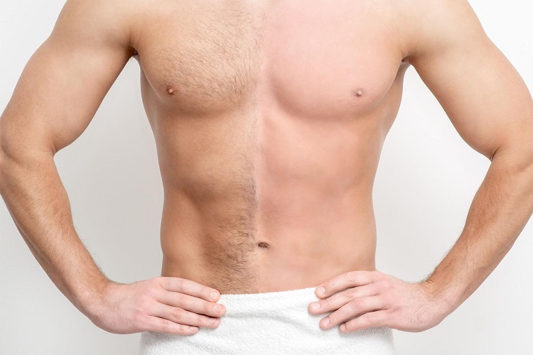 body hair without pain